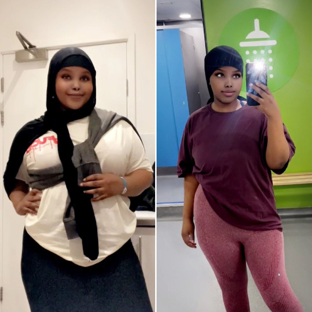 Gastric Sleeve Before & After 8