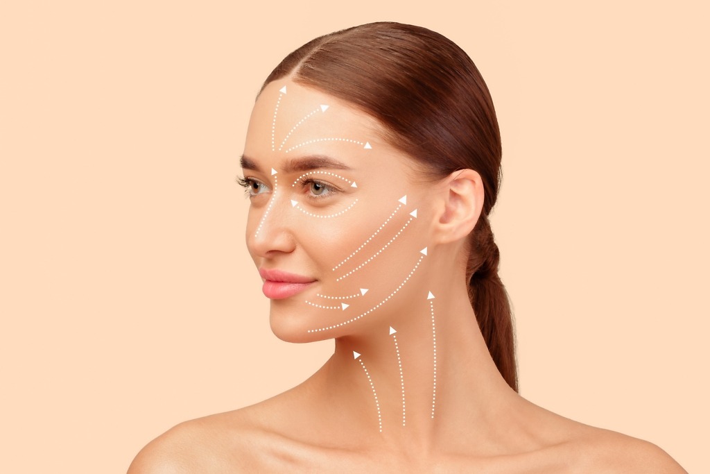 A woman with smooth, lifted skin after a traditional facelift and neck lift