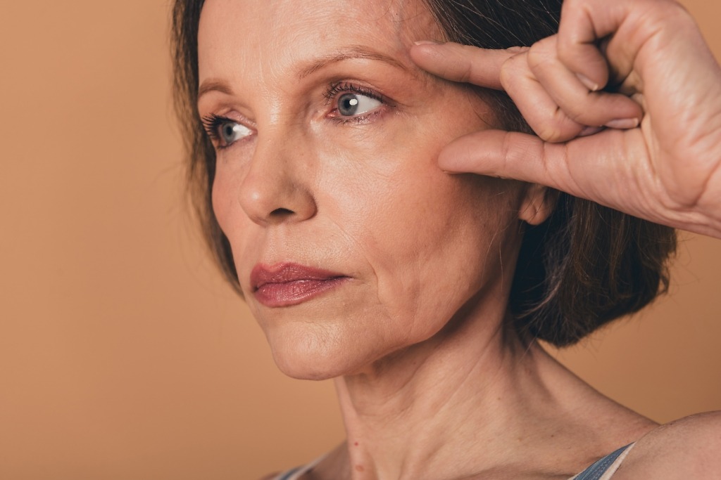 Older woman lifting skin on her face, illustrating facial sagging and skin laxity