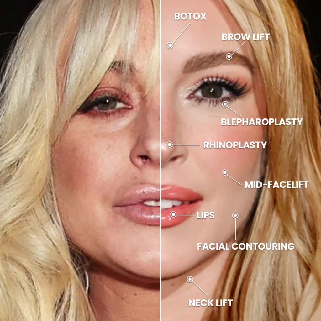 lindsay lohan photo v x