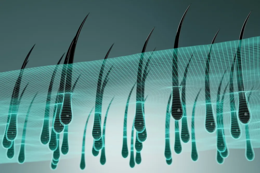 Hair Transplant in Turkey | Hair Loss: Causes & Solutions