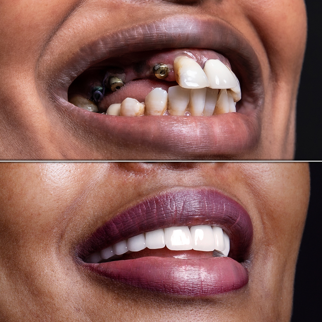 before-after-1.jpg