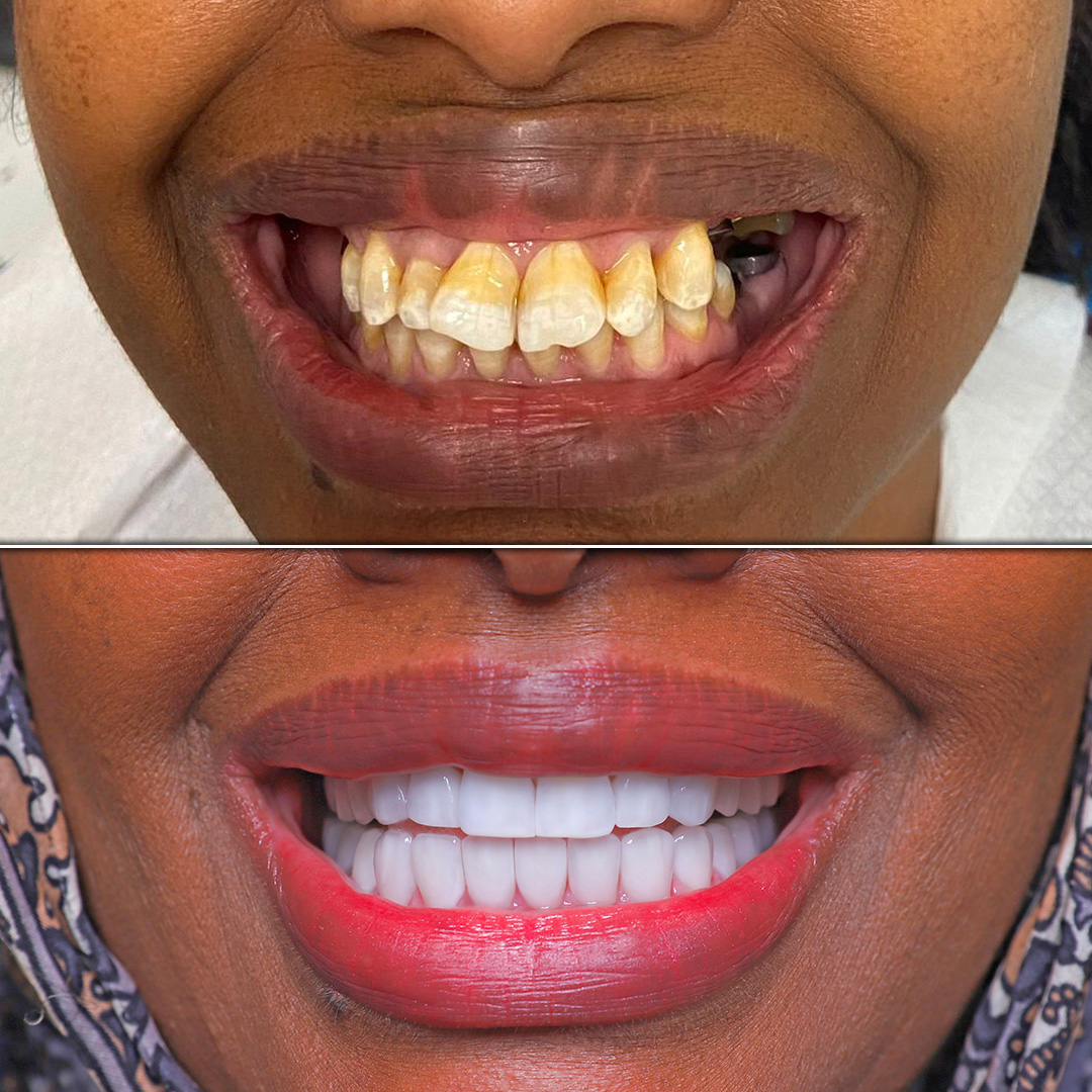 before-after-2.jpg