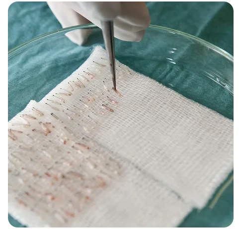 Harvesting Hair Follicles