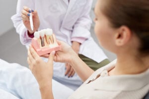 Dental implant procedure step showing titanium implant placement in jawbone