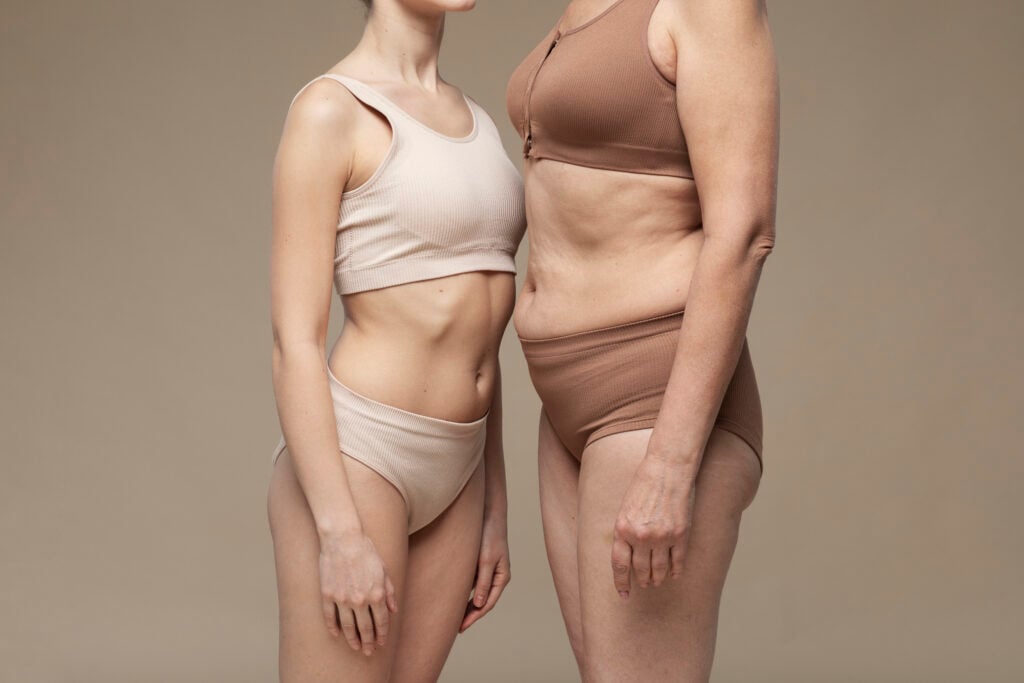 tummy tuck vs liposuction before and after comparison showing belly fat and loose skin results