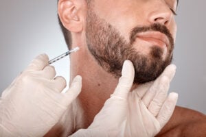 Man with natural beard transplant results in Turkey