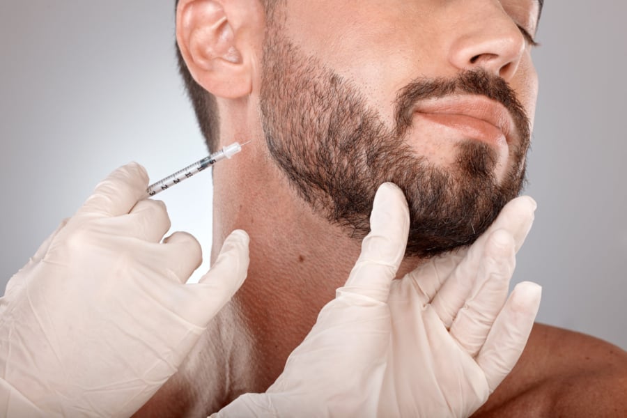 Beard Transplant Cost & Results in Turkey